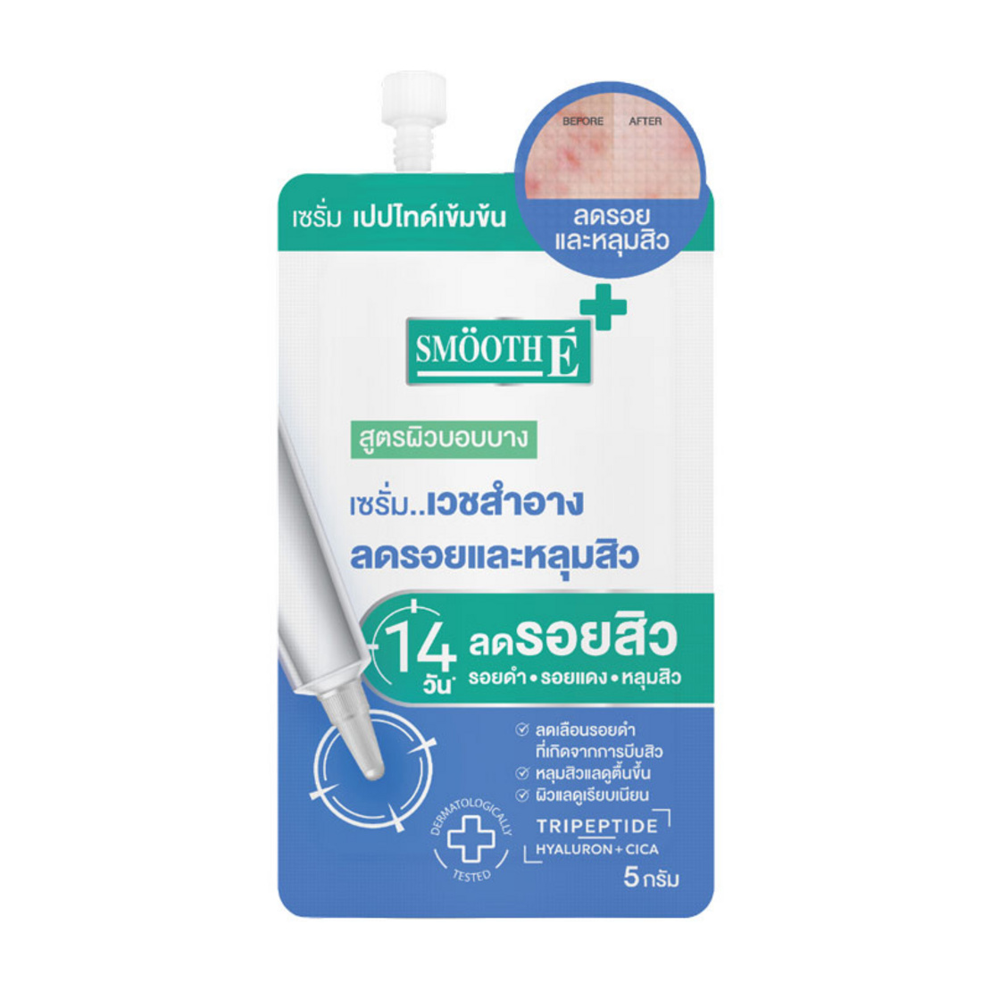 Smooth E Acne Scar Serum 5g.